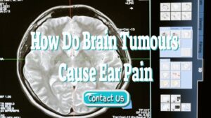 How Do Brain Tumours Cause Ear Pain – Including Aneurysms