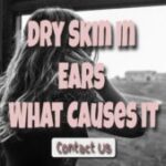 Dry skin