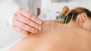 Can Acupuncture Help During Pregnancy? Yes, It Can!