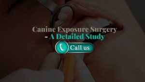 Canine Exposure Surgery – A Detailed Study