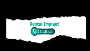 Dental Implants in Forest Hills Queens, NY