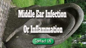 What Is the Definition of a Middle Ear Infection or Inflammation