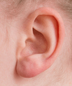 ear wax removal near me