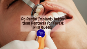 Do Dental Implants better than Dentures for Forest Hills Queens, NY ?