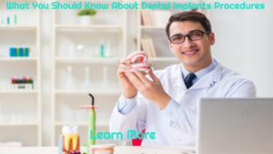 What You Should Know About Dental Implants Procedures