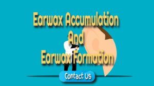 Concerning Earwax Accumulation and Earwax Formation