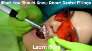 What You Should Know About Dental Fillings