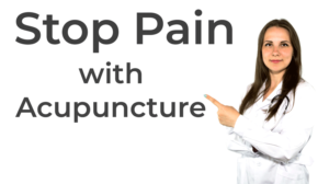 Acupuncture Tips That Will Help You Improve Your Health