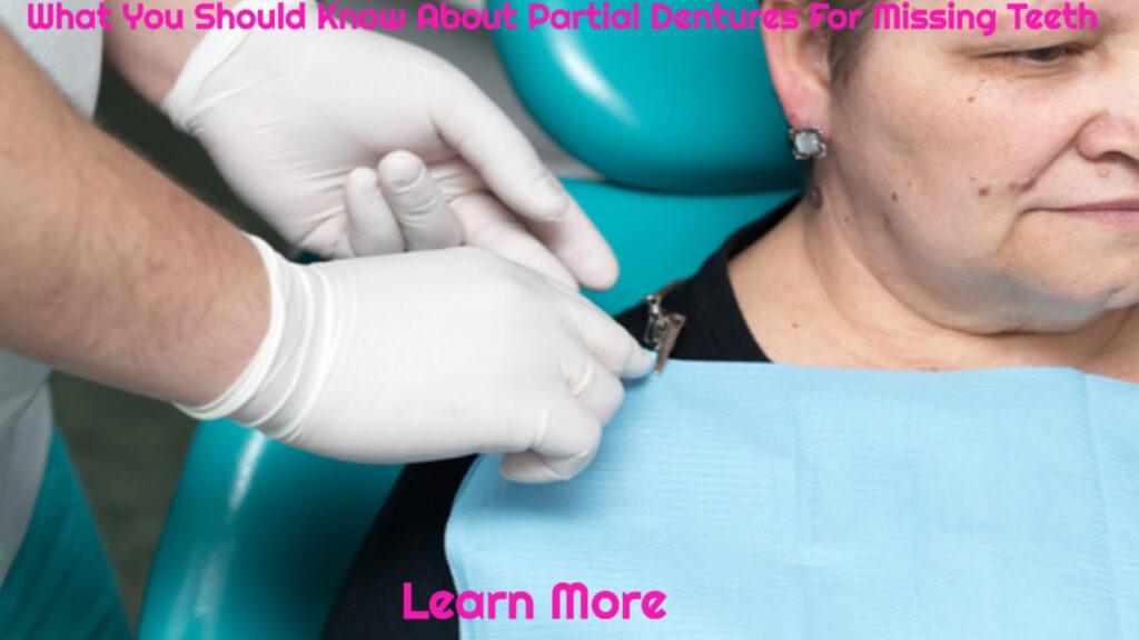 What You Should Know About Partial Dentures