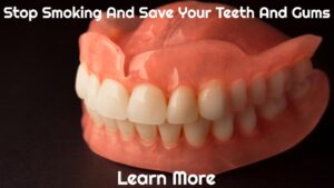 Stop Smoking And Save Your Teeth And Gums