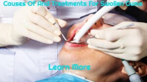 Causes Of And Treatments For Swollen Gums