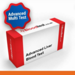 Liver Blood Test Insights for Birmingham Residents