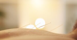 Acupuncture for Natural Recovery and Healing Benefits