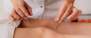 Acupuncture for Stress and Anxiety: Essential Guide